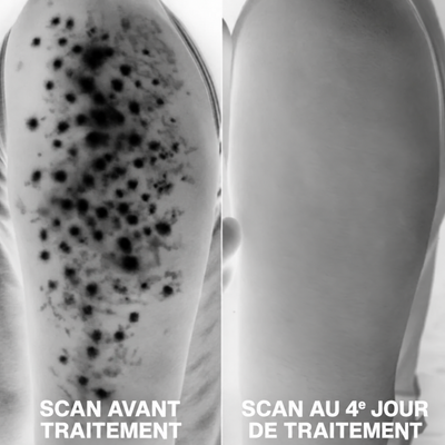 Nuancia — Soin dermocosmétique triple-acide
