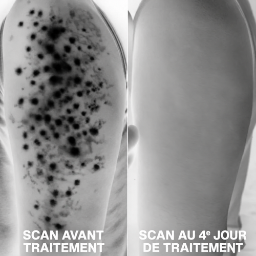 Nuancia — Soin dermocosmétique triple-acide