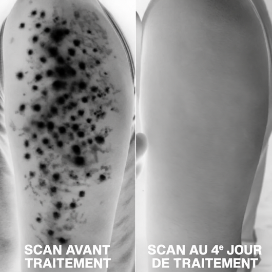 Nuancia — Soin dermocosmétique triple-acide