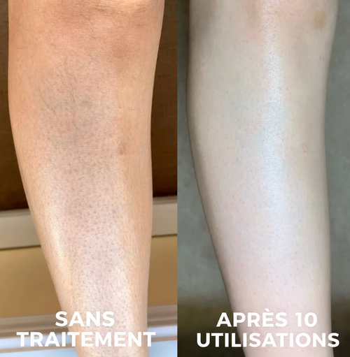 Nuancia — Soin dermocosmétique triple-acide
