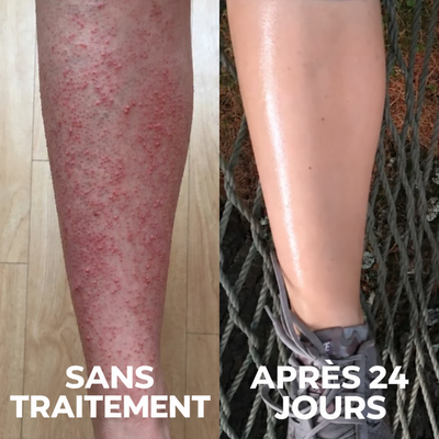 Nuancia — Soin dermocosmétique triple-acide